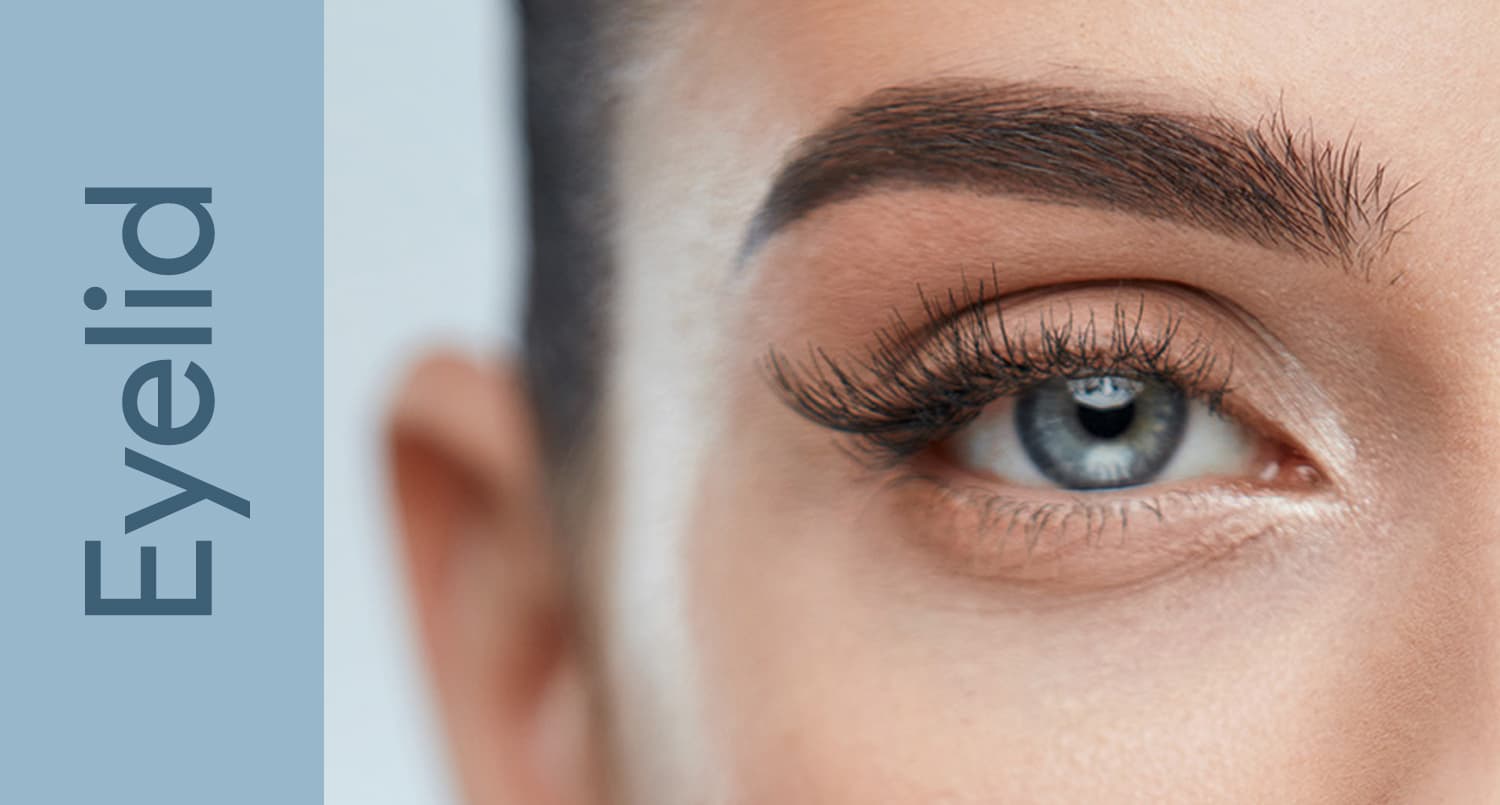 Upper Eyelid Blepharoplasty