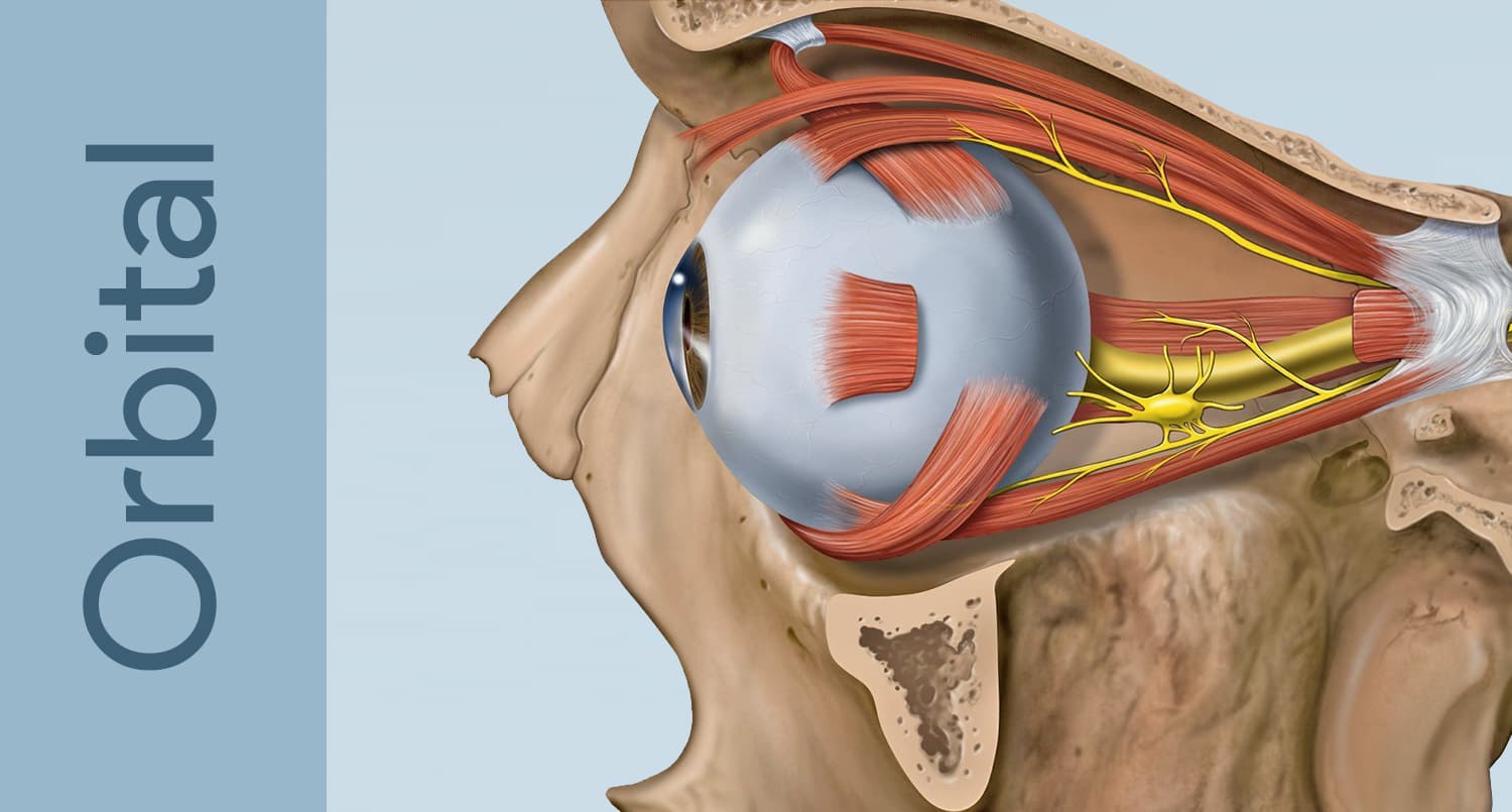 Anophthalmos — Resources & References