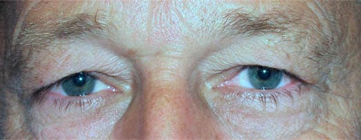 Before β Age 50