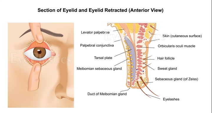 Section of eyelid and eyelid retracted, anterior view