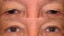 Before and after image of a 59 year old person's transformation