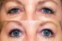 Before and after comparison of a photo from the national database, showing changes over time. Image ID: 44Y