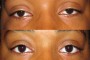 Before and after photo showing a 30-year-old person from the national database