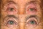 Before and after image showing 83Y from the national database