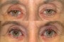 Before and after photo showing a person's face from the national database, with noticeable changes in appearance