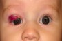 Image showing the condition 2 months after treatment started