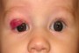 Image showing the condition 4 months after treatment started