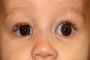 A medical image showing progress 9 months after treatment initiation.