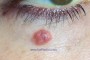 Thumbnail image of P0001672 with 70% opacity