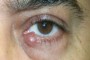 A thumbnail image with the title P0006483