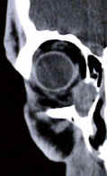 Person crying, with the text 'Emotional Breakdown' embedded