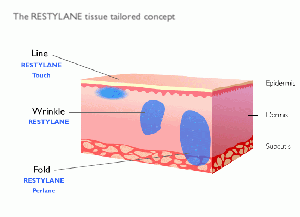 Illustration showing how Restylane works with other substances