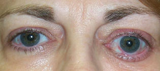 Pre and Post Operative Photograph P00047641