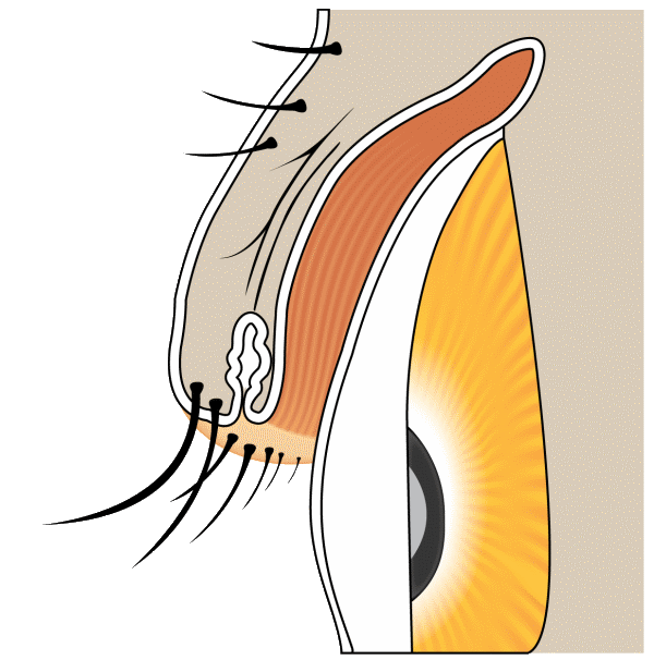 Illustration demonstrating normal lashes