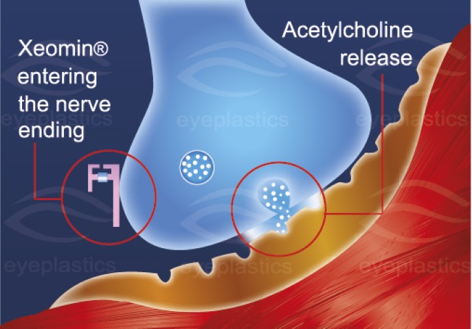 Illustration showing a diagram related to Xeomin, a botulinum toxin product.