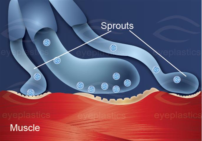 Illustration showing the structure of Botulinum toxin.